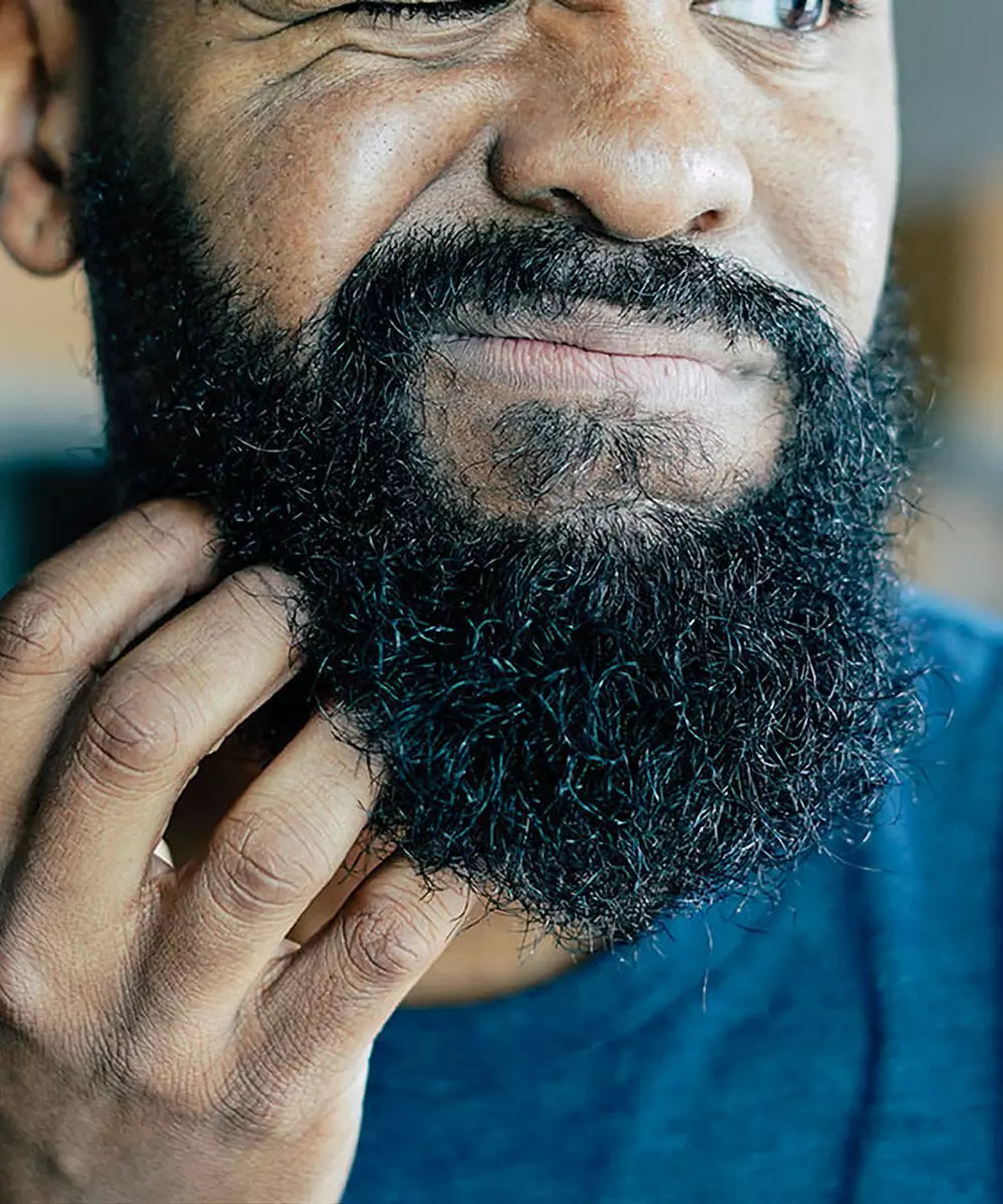 itchiness in beard